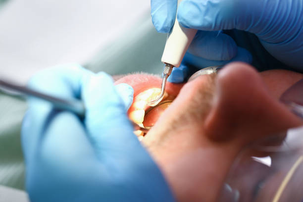 Best Broken Tooth Emergency  in North Brooksville, FL