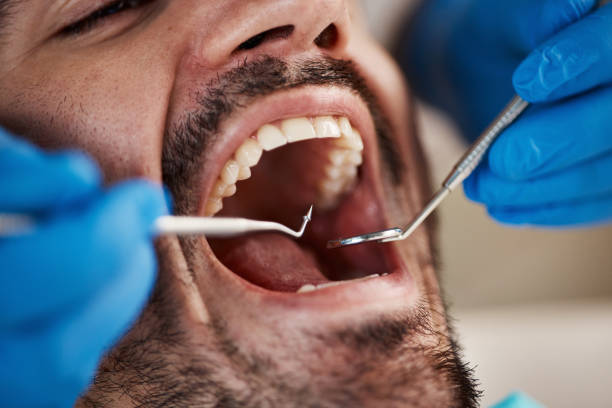 Best Teeth Whitening  in North Brooksville, FL