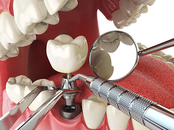 Best Dentist for Severe Toothache  in North Brooksville, FL
